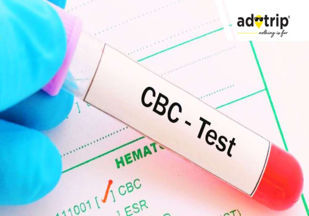 cbc cost in india, cbc (complete blood count) test price in india